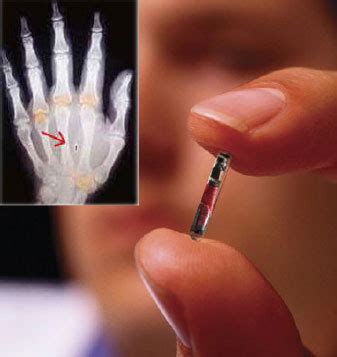 rfid chip 2014 news|chip implanted in the hand.